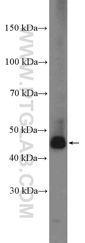 ALDH9A1 Antibody in Western Blot (WB)