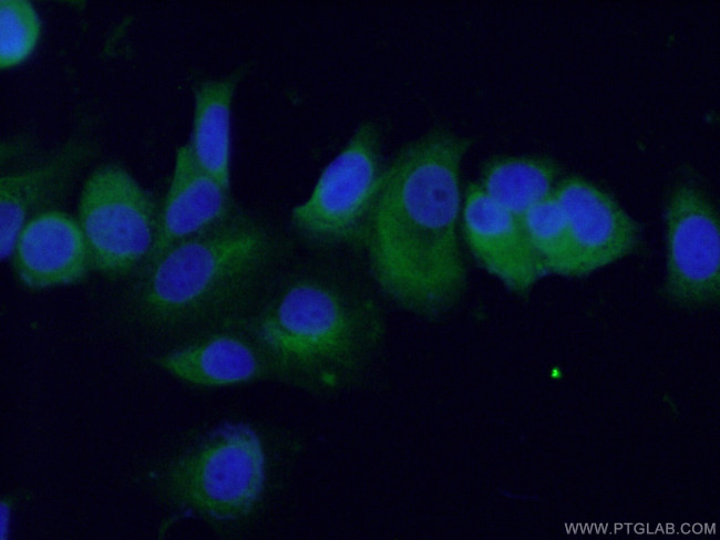 BAG5 Antibody in Immunocytochemistry (ICC/IF)