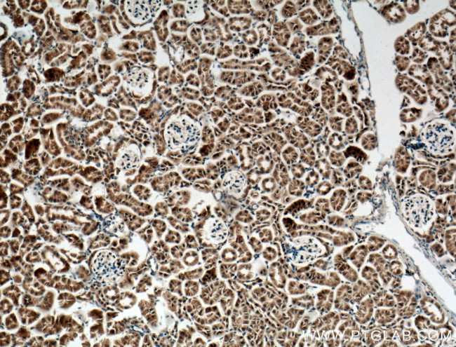 CLRN1 Antibody in Immunohistochemistry (Paraffin) (IHC (P))