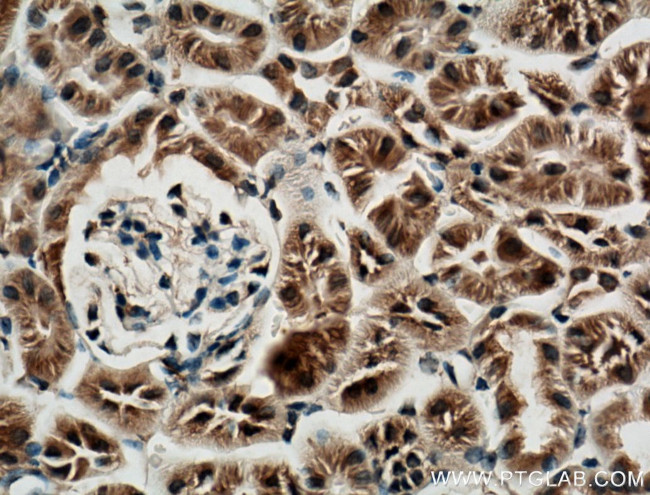 CLRN1 Antibody in Immunohistochemistry (Paraffin) (IHC (P))