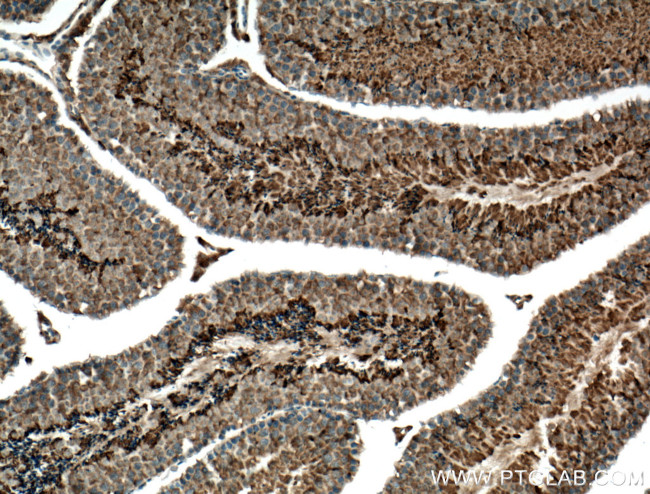 CLRN1 Antibody in Immunohistochemistry (Paraffin) (IHC (P))