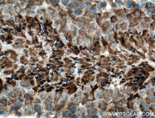 CLRN1 Antibody in Immunohistochemistry (Paraffin) (IHC (P))