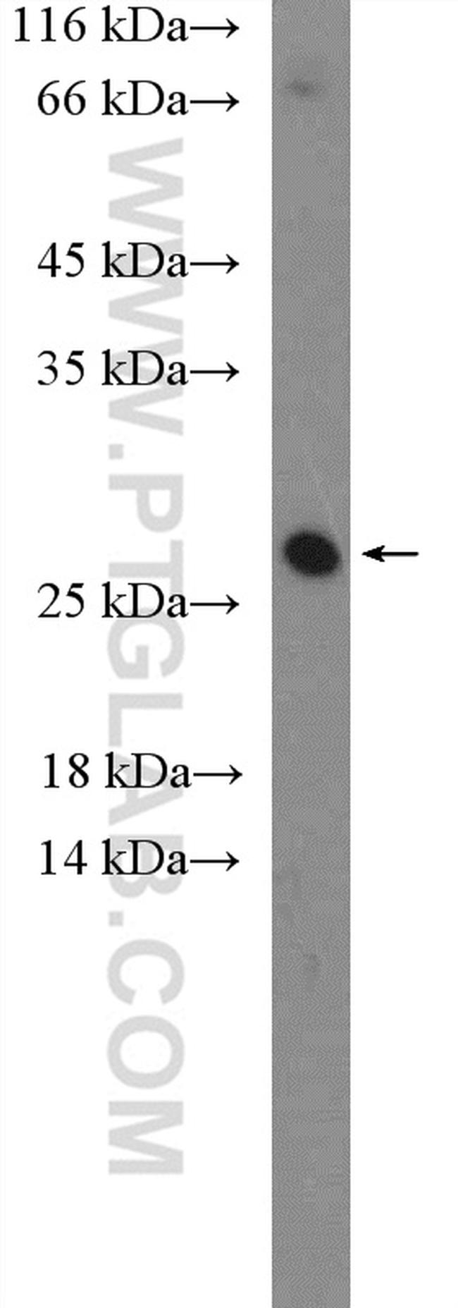 CLRN1 Antibody in Western Blot (WB)