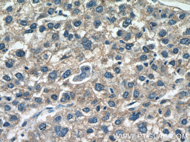 AADAC Antibody in Immunohistochemistry (Paraffin) (IHC (P))