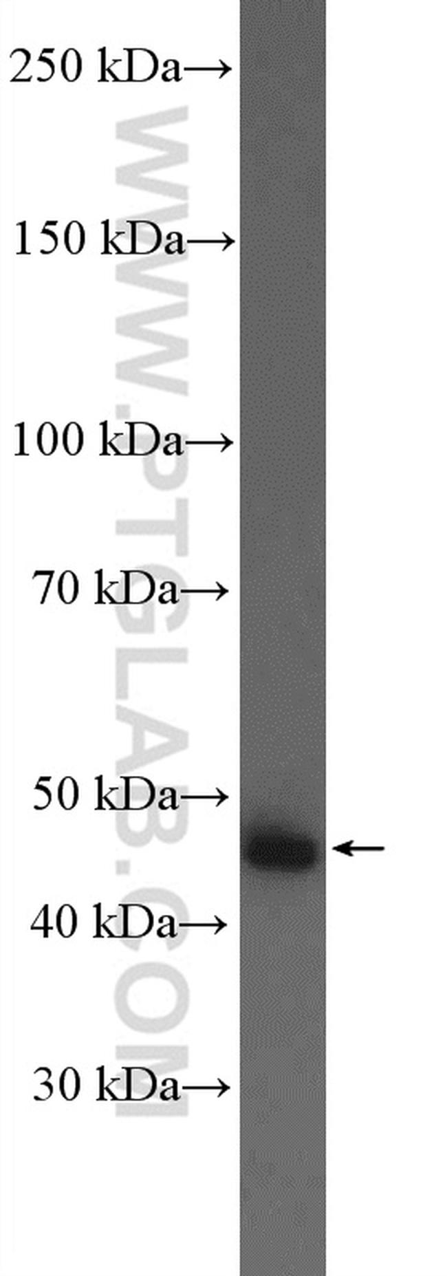 AADAC Antibody in Western Blot (WB)