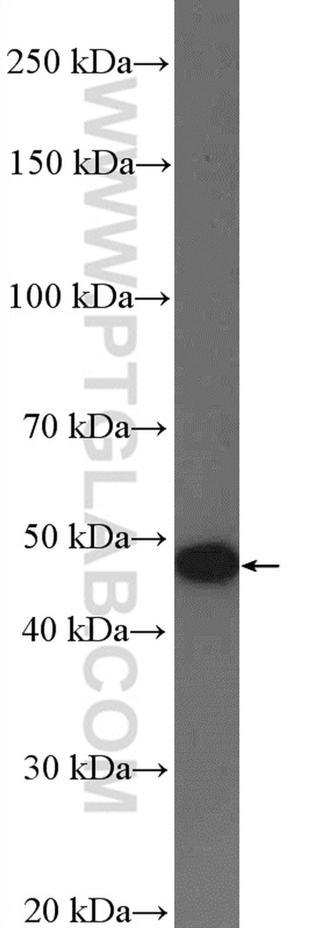 AADAC Antibody in Western Blot (WB)