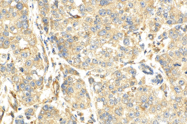 PCID2 Antibody in Immunohistochemistry (Paraffin) (IHC (P))