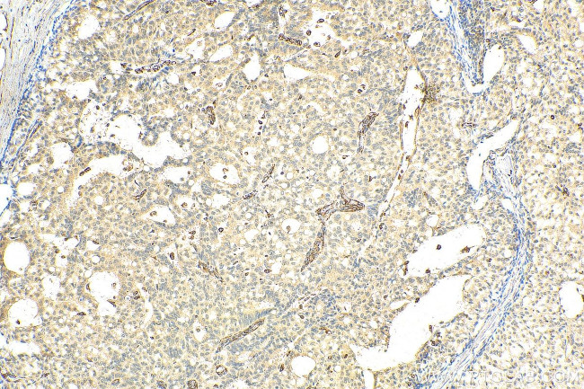 PCID2 Antibody in Immunohistochemistry (Paraffin) (IHC (P))