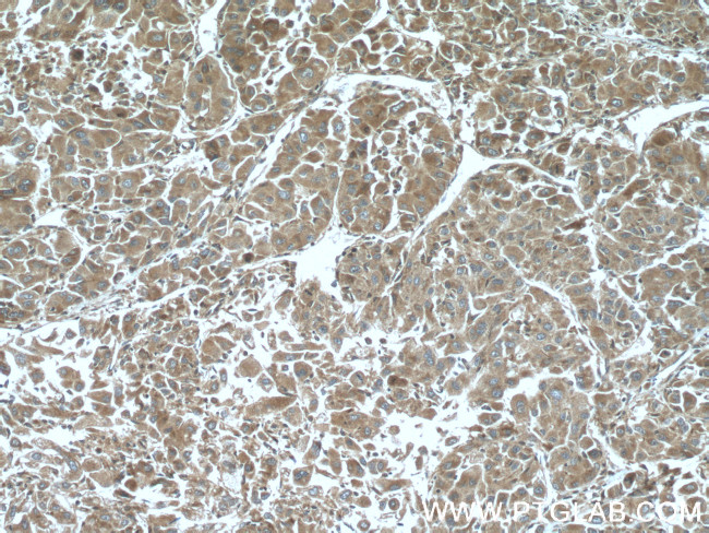 ELAC1 Antibody in Immunohistochemistry (Paraffin) (IHC (P))