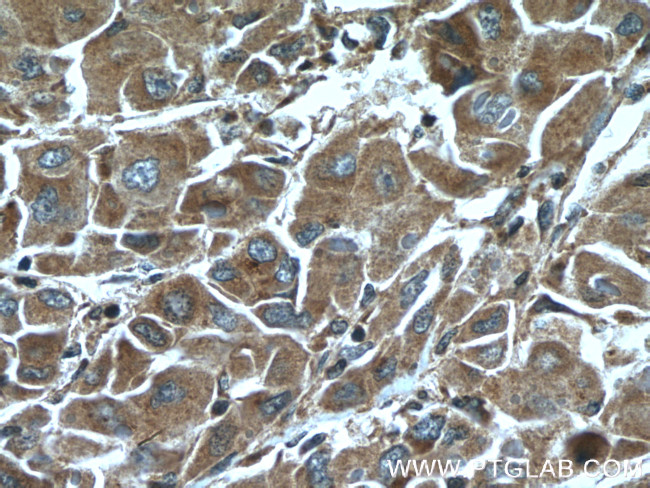 ELAC1 Antibody in Immunohistochemistry (Paraffin) (IHC (P))