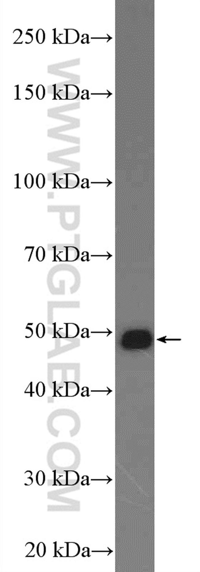 ELAC1 Antibody in Western Blot (WB)