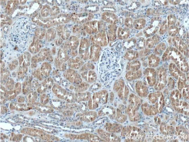 PEX13 Antibody in Immunohistochemistry (Paraffin) (IHC (P))