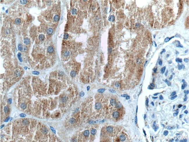 PEX13 Antibody in Immunohistochemistry (Paraffin) (IHC (P))