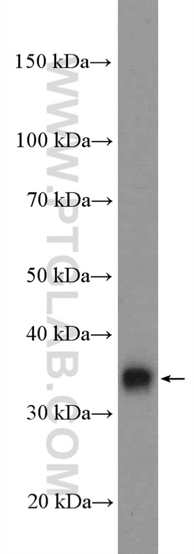 LIN37 Antibody in Western Blot (WB)