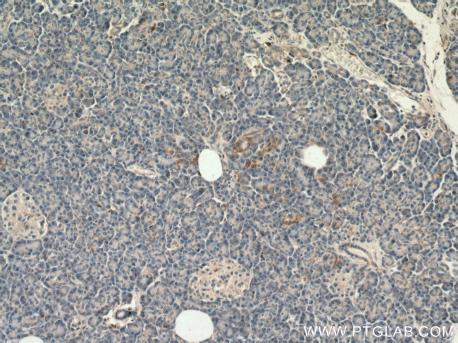 SLC25A29 Antibody in Immunohistochemistry (Paraffin) (IHC (P))