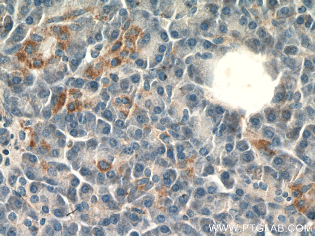 SLC25A29 Antibody in Immunohistochemistry (Paraffin) (IHC (P))