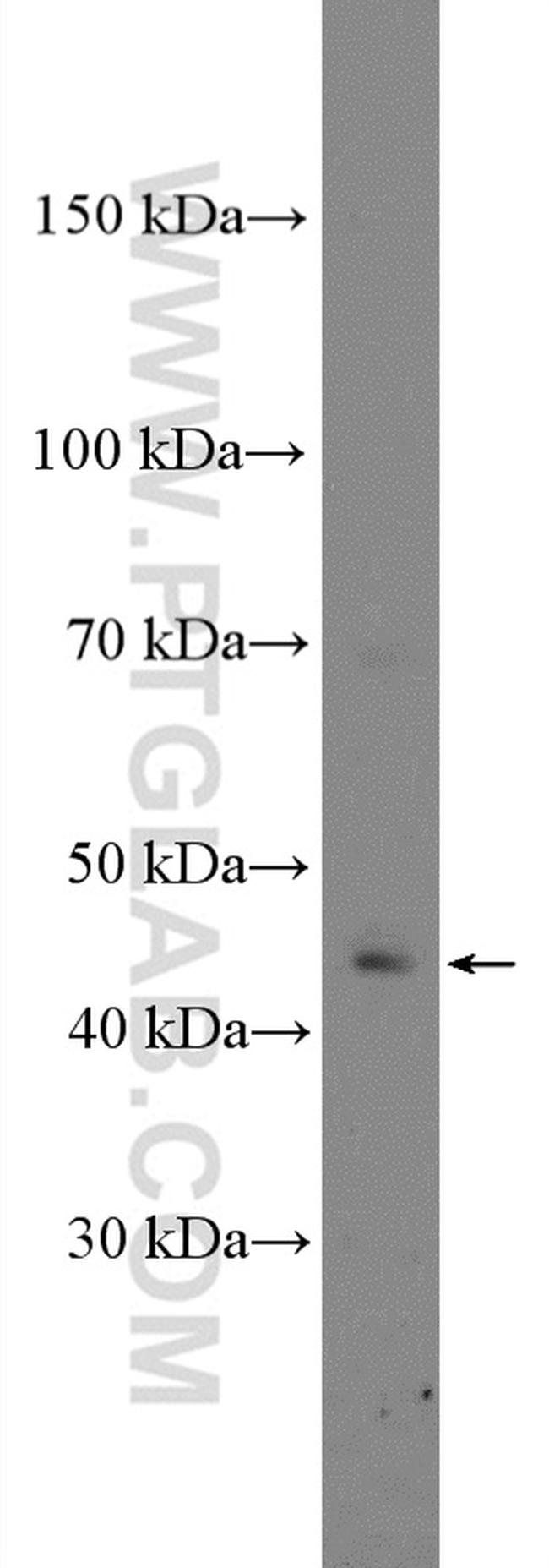 Calsequestrin Antibody in Western Blot (WB)