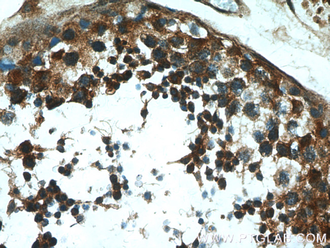 MAEL Antibody in Immunohistochemistry (Paraffin) (IHC (P))