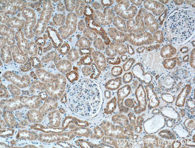 BDKRB1 Antibody in Immunohistochemistry (Paraffin) (IHC (P))