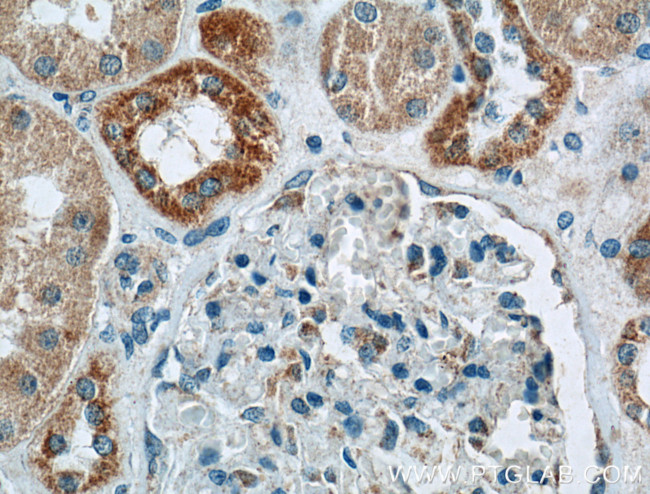 BDKRB1 Antibody in Immunohistochemistry (Paraffin) (IHC (P))