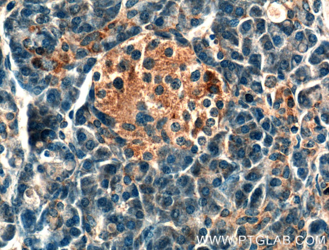 BDKRB1 Antibody in Immunohistochemistry (Paraffin) (IHC (P))