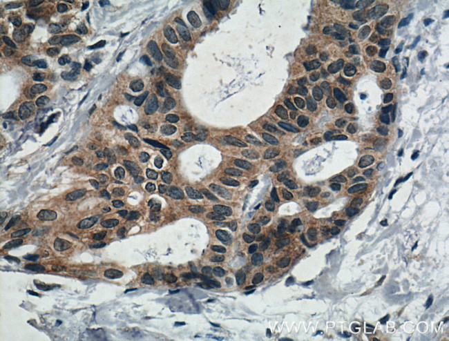 IL5 Antibody in Immunohistochemistry (Paraffin) (IHC (P))