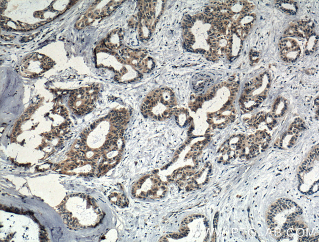 IL5 Antibody in Immunohistochemistry (Paraffin) (IHC (P))