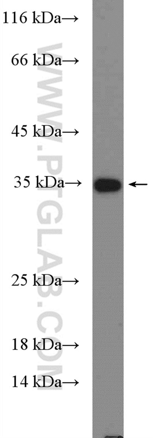 IL5 Antibody in Western Blot (WB)