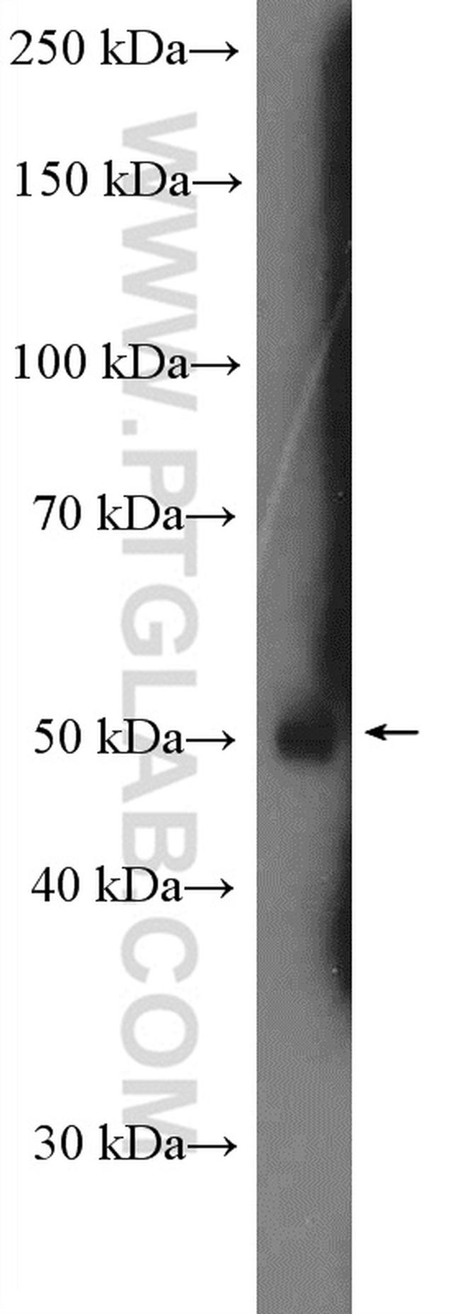 ATP6V1H Antibody in Western Blot (WB)