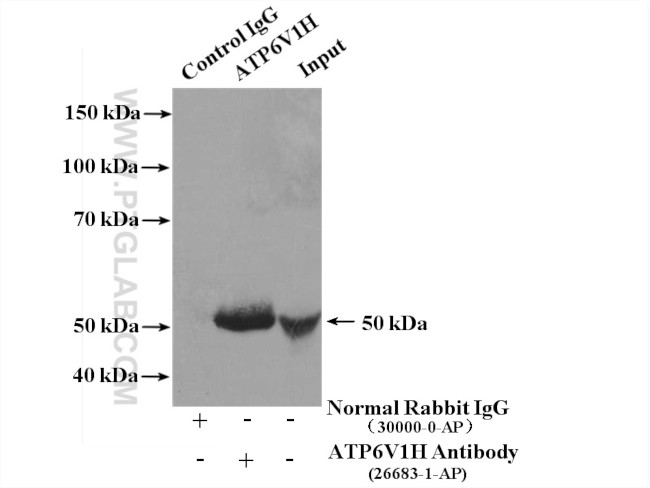 ATP6V1H Antibody in Immunoprecipitation (IP)