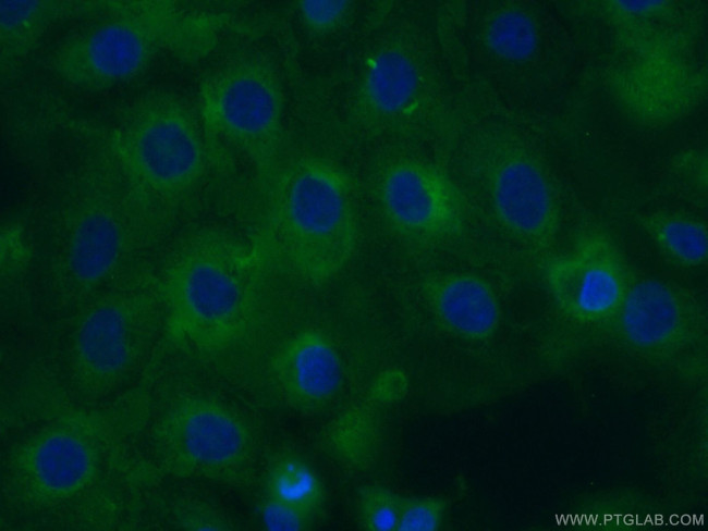 CYR61/CCN1 Antibody in Immunocytochemistry (ICC/IF)