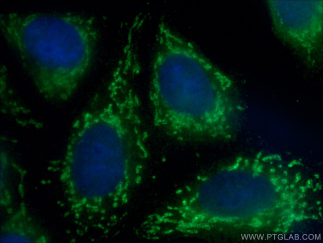 CYR61/CCN1 Antibody in Immunocytochemistry (ICC/IF)