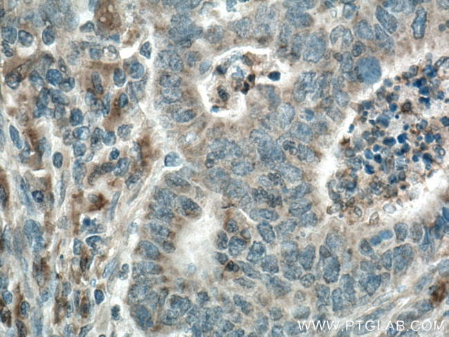 CYR61/CCN1 Antibody in Immunohistochemistry (Paraffin) (IHC (P))