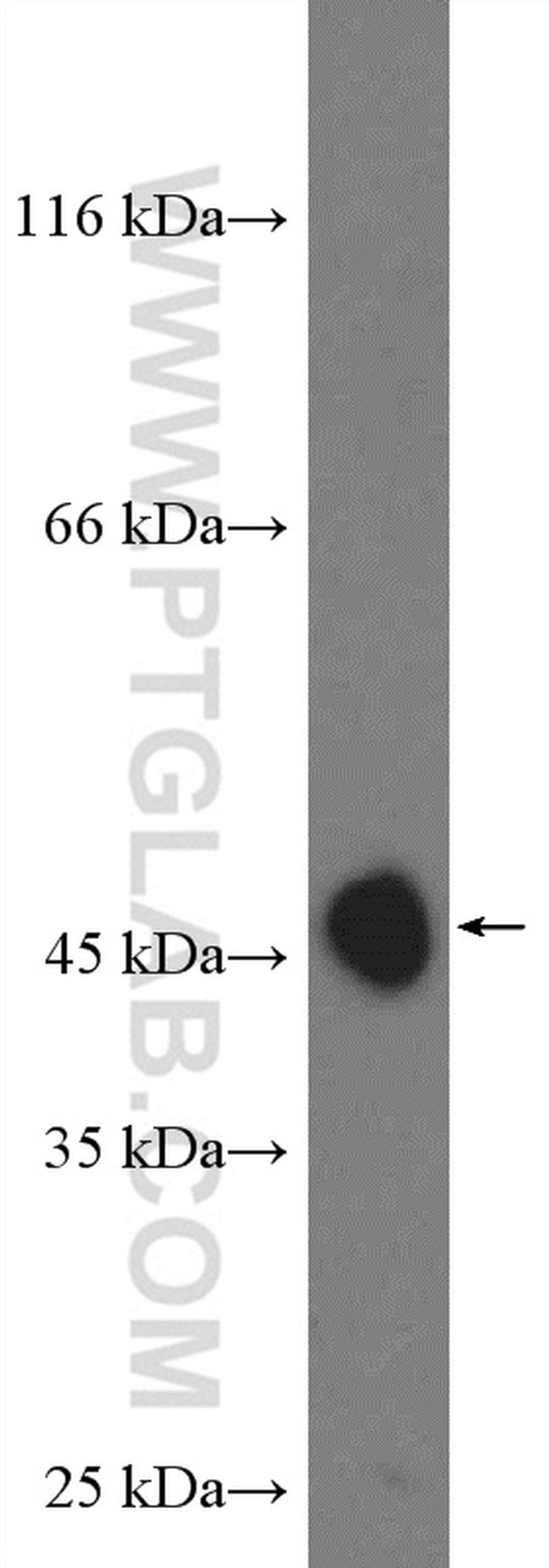 CYR61/CCN1 Antibody in Western Blot (WB)