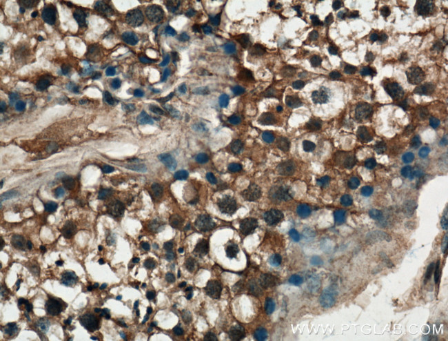 P3H1 Antibody in Immunohistochemistry (Paraffin) (IHC (P))