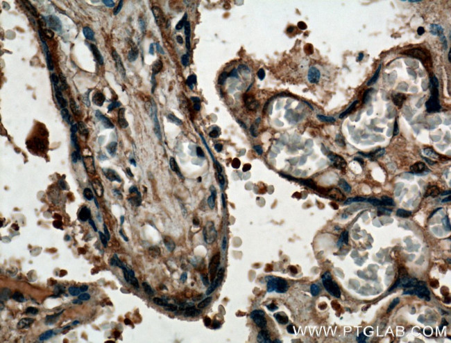 P3H1 Antibody in Immunohistochemistry (Paraffin) (IHC (P))