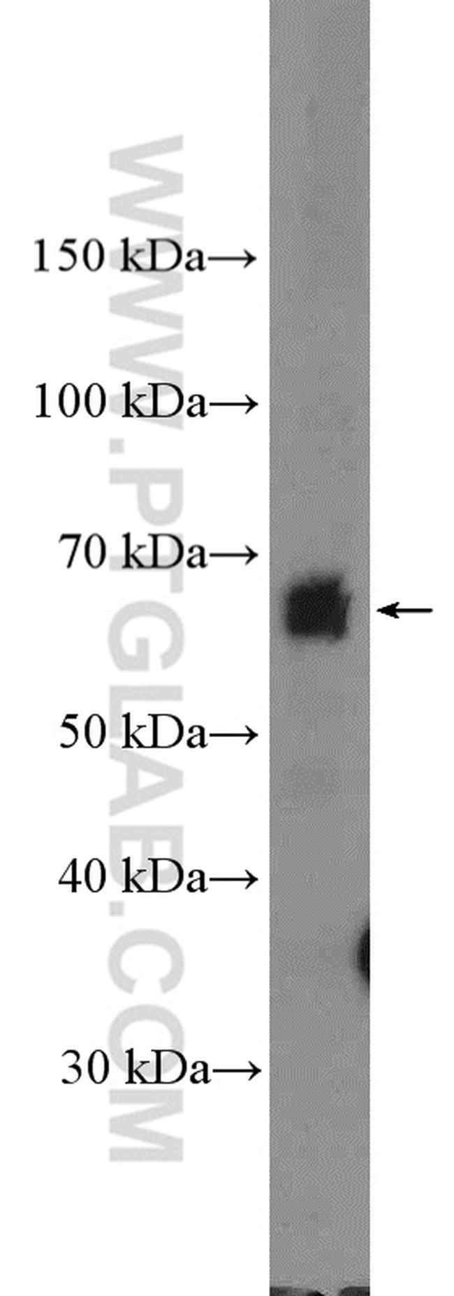 TRAF3IP2 Antibody in Western Blot (WB)