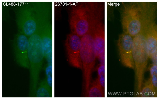 WDR35 Antibody in Immunocytochemistry (ICC/IF)