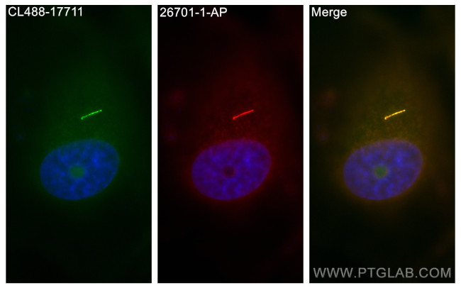 WDR35 Antibody in Immunocytochemistry (ICC/IF)