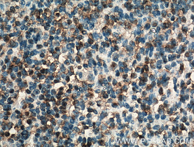 BSAP/PAX5 Antibody in Immunohistochemistry (Paraffin) (IHC (P))