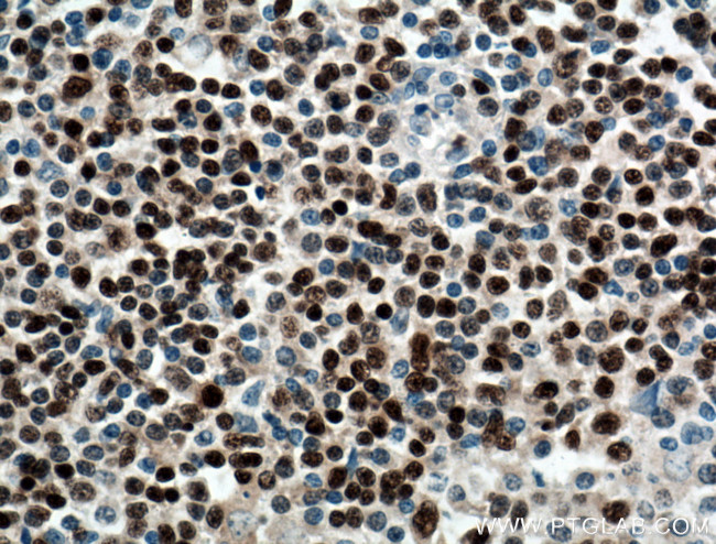 BSAP/PAX5 Antibody in Immunohistochemistry (Paraffin) (IHC (P))