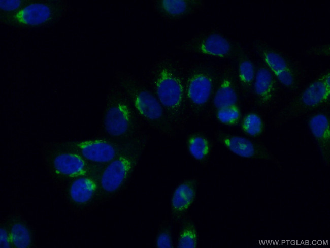 NUCB2/nesfatin-1 Antibody in Immunocytochemistry (ICC/IF)