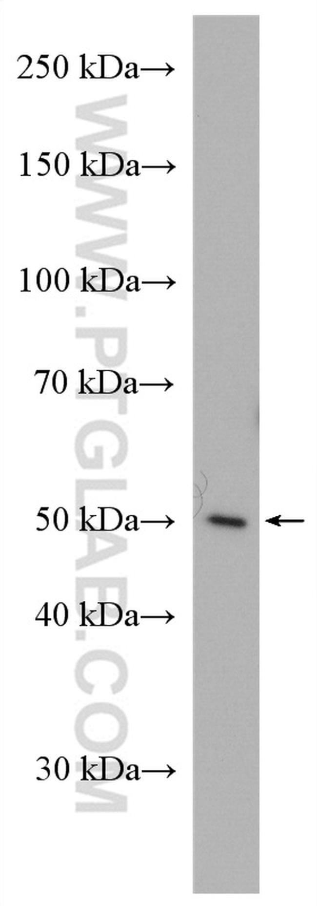 NUCB2/nesfatin-1 Antibody in Western Blot (WB)