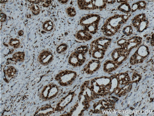 P27/KIP1 Antibody in Immunohistochemistry (Paraffin) (IHC (P))