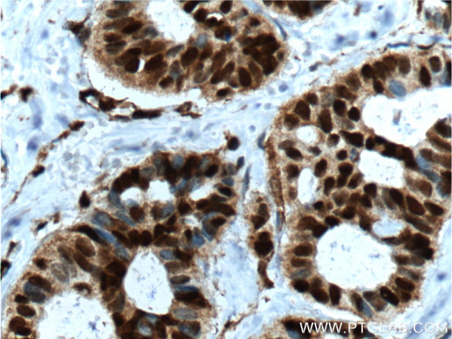 P27/KIP1 Antibody in Immunohistochemistry (Paraffin) (IHC (P))