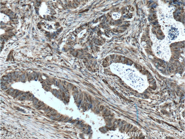 P27/KIP1 Antibody in Immunohistochemistry (Paraffin) (IHC (P))