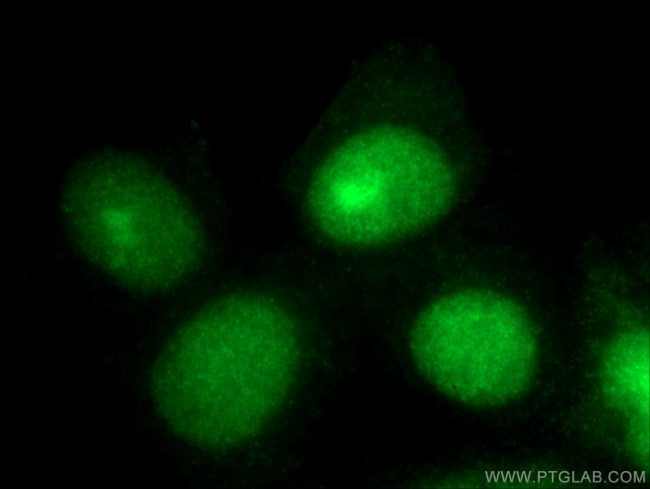 P27/KIP1 Antibody in Immunocytochemistry (ICC/IF)