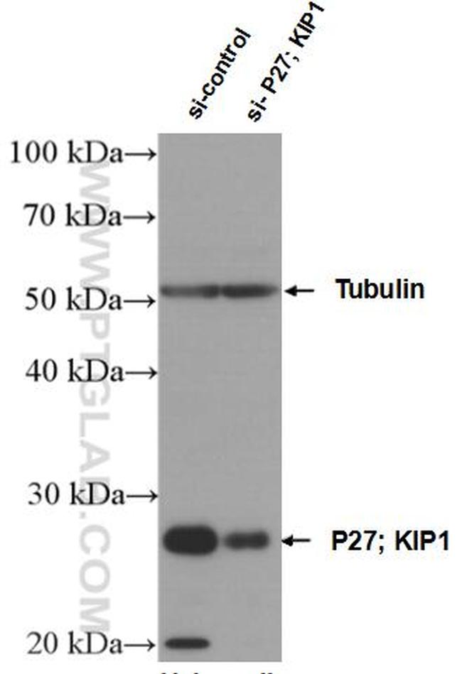 P27/KIP1 Antibody in Western Blot (WB)