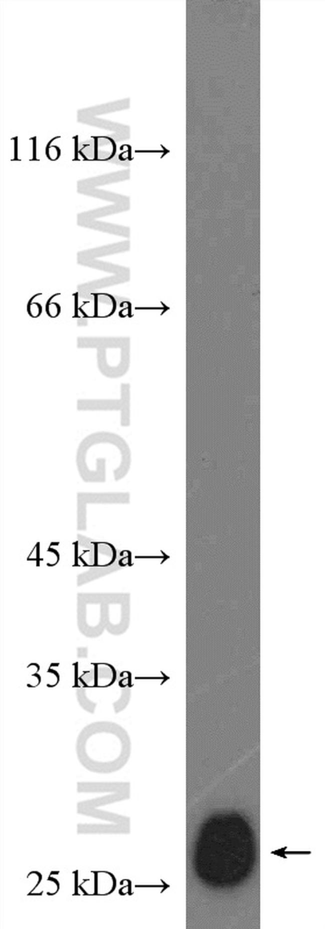 P27/KIP1 Antibody in Western Blot (WB)