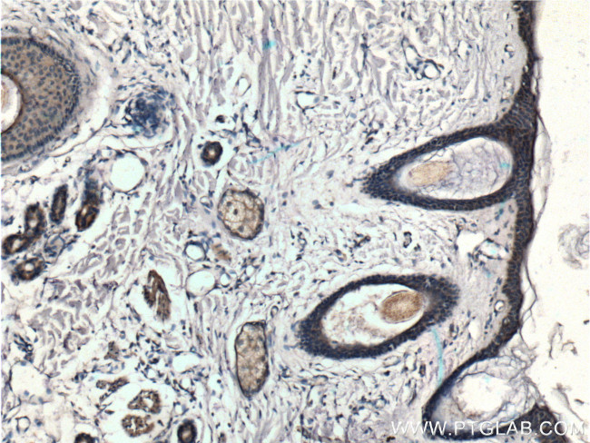 SLC17A9 Antibody in Immunohistochemistry (Paraffin) (IHC (P))